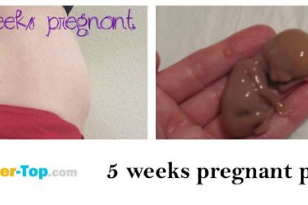 Кракен зеркало маркетплейс